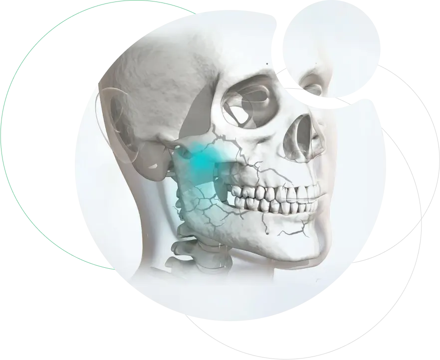 Facial Trauma and Oral Injuries