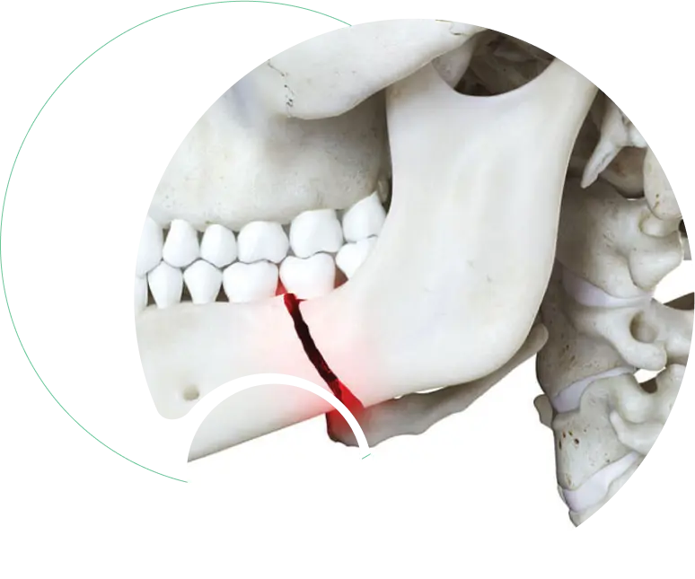 Facial Trauma and Oral Injuries