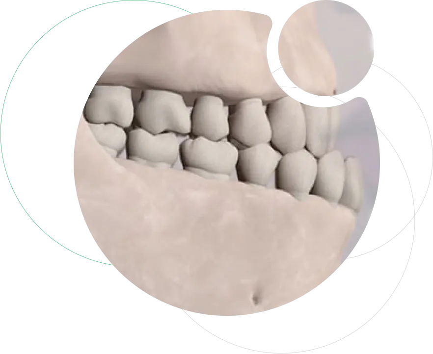 Jaw Deformity Correction