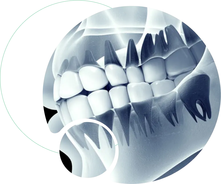 Jaw Deformity Correction