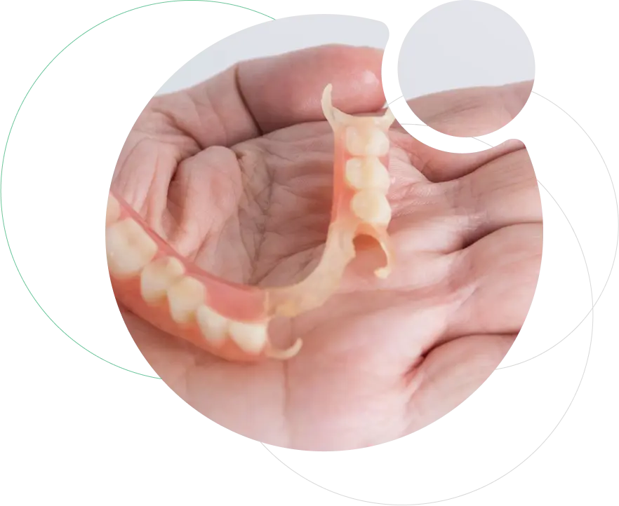 Removable Partial Dentures