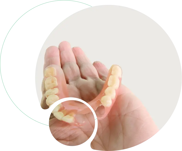 Removable Partial Dentures