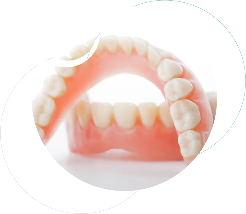 Removable Partial Dentures