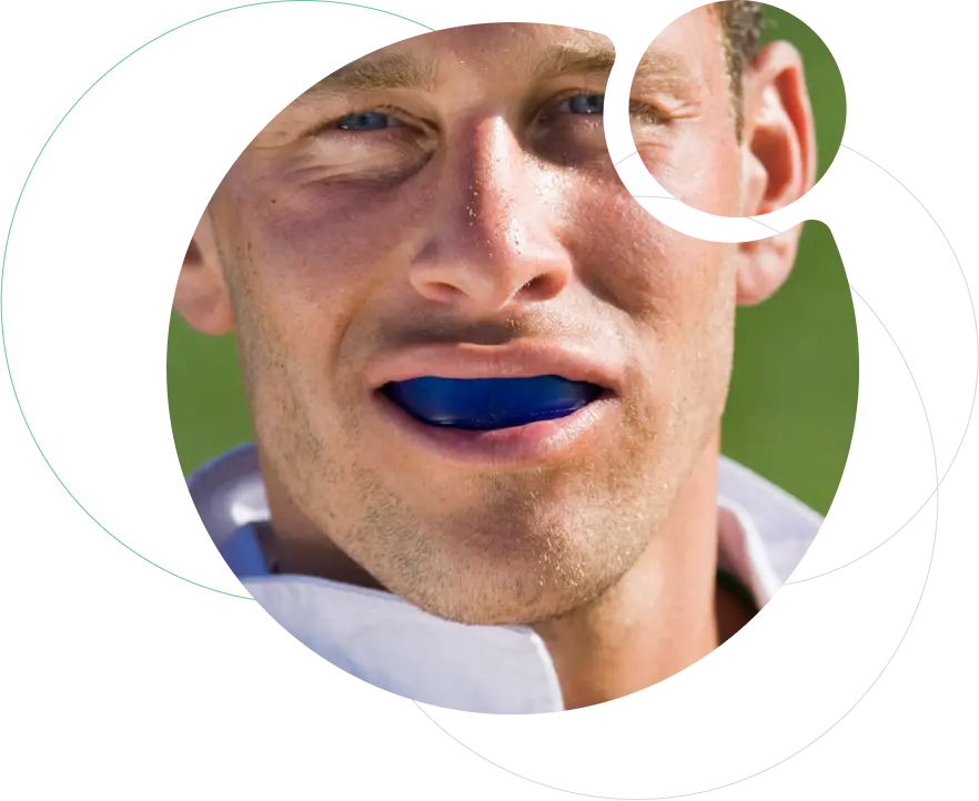 Sports dentistry – Mouth guards