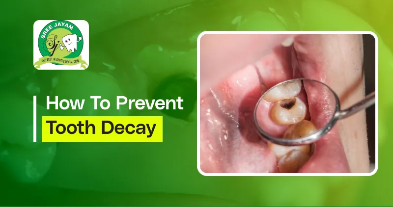 How to Prevent Tooth Decay?